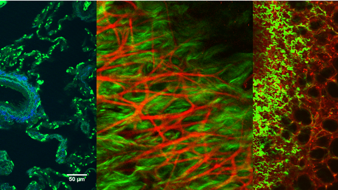 Biophotonics – Institute Of Quantum Optics – Leibniz University Hannover